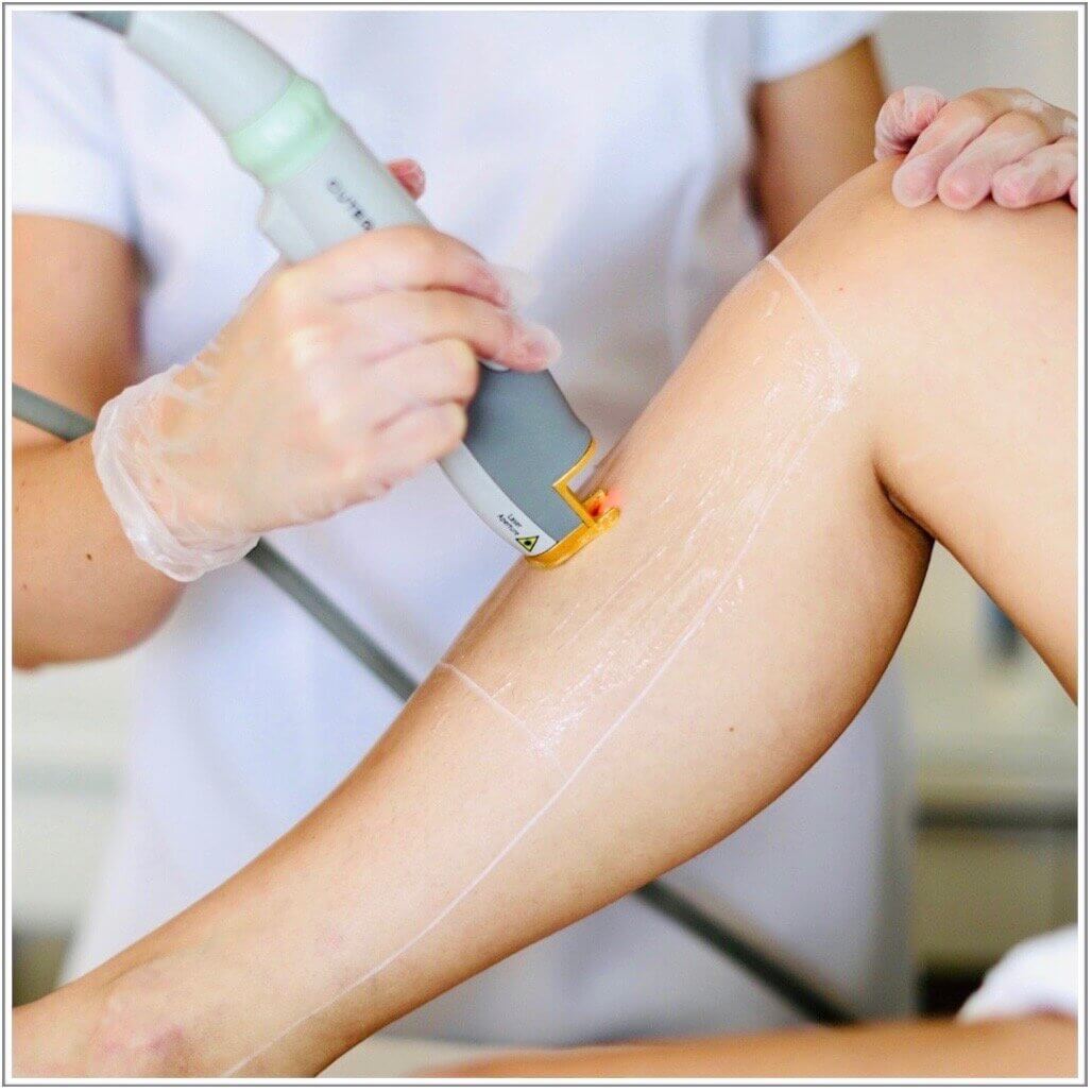 A Guide To Laser Hair Removal — Santi London