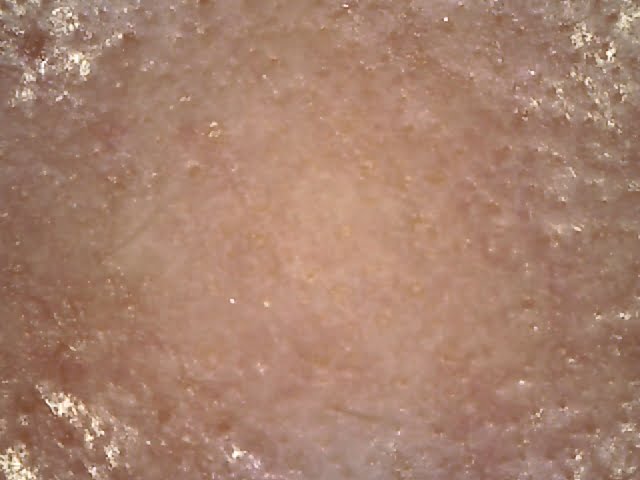 skin under 100x magnification